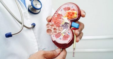 Chronic kidney disease, doctor with model for treatment urinary system, urology, Estimated glomerular filtration rate eGFR.