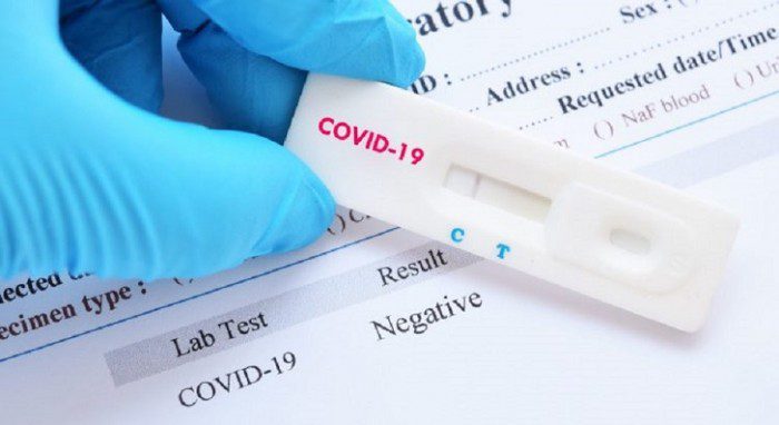 test coronavirus